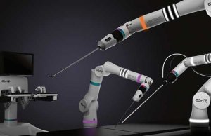 Versius robot arm to transform minor operations