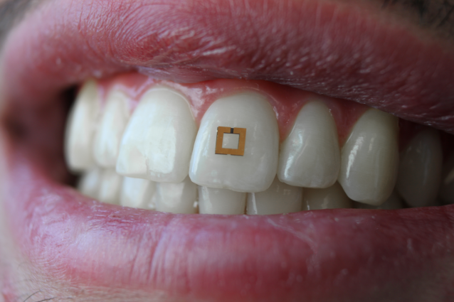 tooth wearable tracks your diet